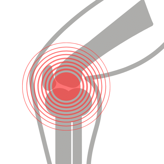 Physiocompass: γόνατα – αστράγαλοι